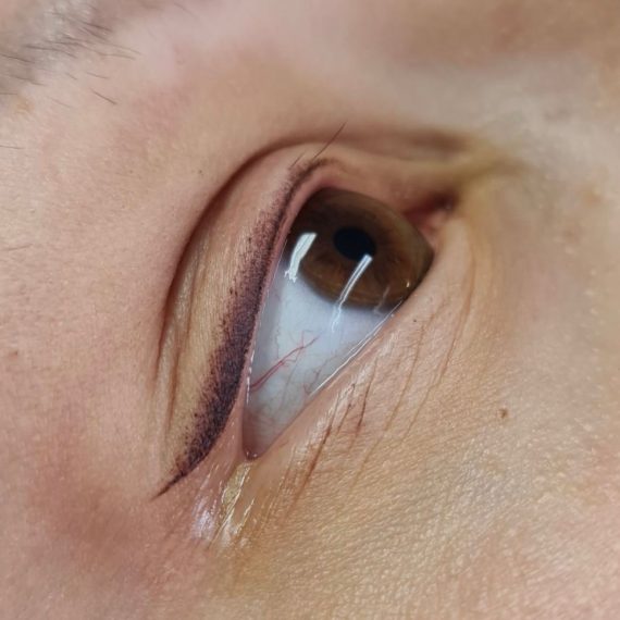 mikropigmentacija kapaka 3